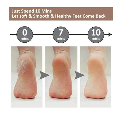Electric Pedicure Dead Skin Remover
